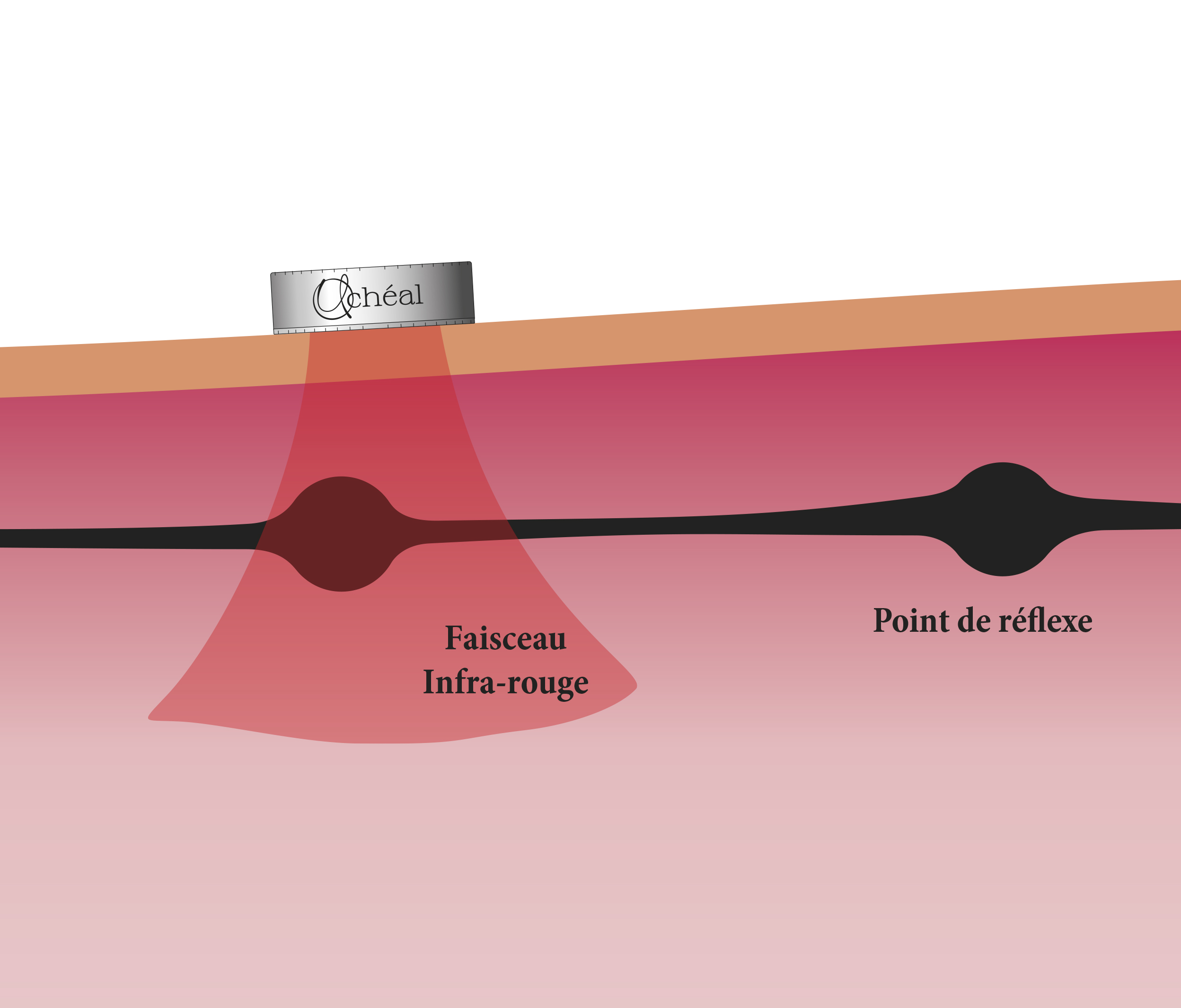 Aculumière_Faisceau infra-rouge 2